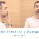 ¿Cómo cambia tu cara cuando te quitan los brackets? Descubre cómo lucirás después del tratamiento