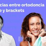 Comparación de rapidez entre brackets e Invisalign