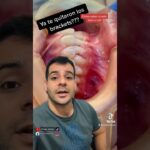 Dientes desalineados después de retirar los brackets: ¿qué hacer?
