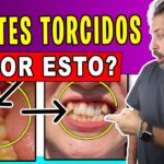 Dientes moviéndose tras extracción de muelas del juicio ¿Qué hacer?