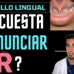 Frenillo de la lengua en adultos riesgos, beneficios y necesidad
