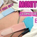 Monitoreo de contracciones en trabajo de parto Guía para entenderlas
