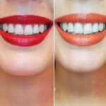 Test de labios: Descubre qué color te favorece