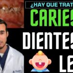 Tratamiento para caries en niños de 3 a 6 años todo lo que debes saber